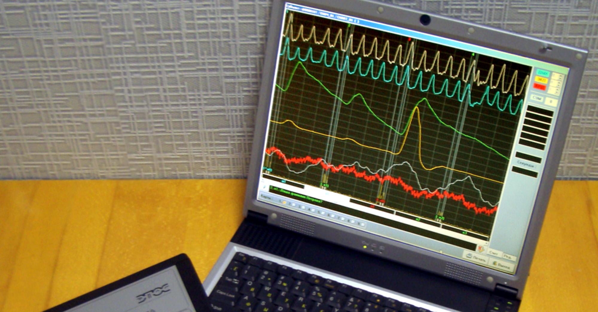 Computer-based polygraph display